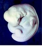 Abb. 265: Menschlicher Embryo, 6. Woche
(Zum Vergröern anklicken)