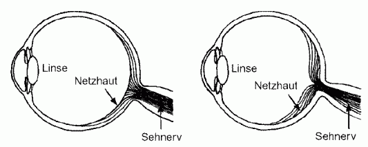 Abb. 79: Aufbau des menschlichen Auges(Zum Vergrößern anklicken)